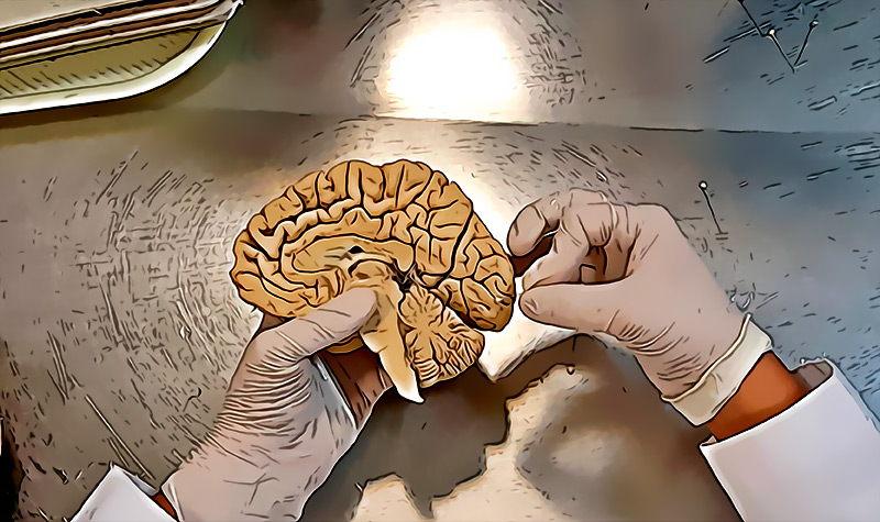 Descubrimos nueva estructura anatomica en el cerebro