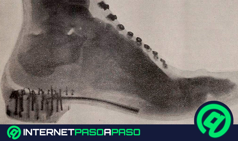 El fluoroscopio: La máquina de rayos X que sirvió para un ajuste perfecto de los zapatos