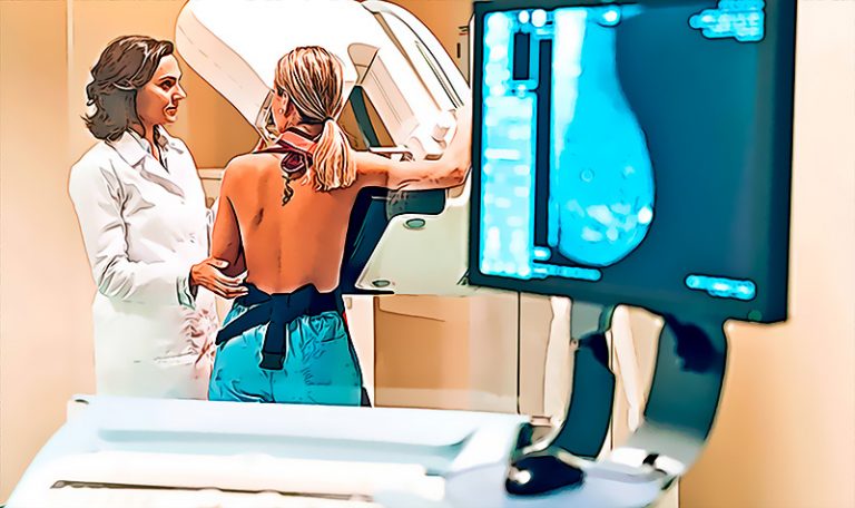 La inteligencia artificial comienza a usarse con exito para detectar cancer de mama mucho mejor de lo que se hacia antes
