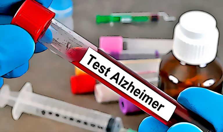 Revolucionario Acabamos de descubrir una forma de diagnosticar el Alzheimer con un analisis de sangre